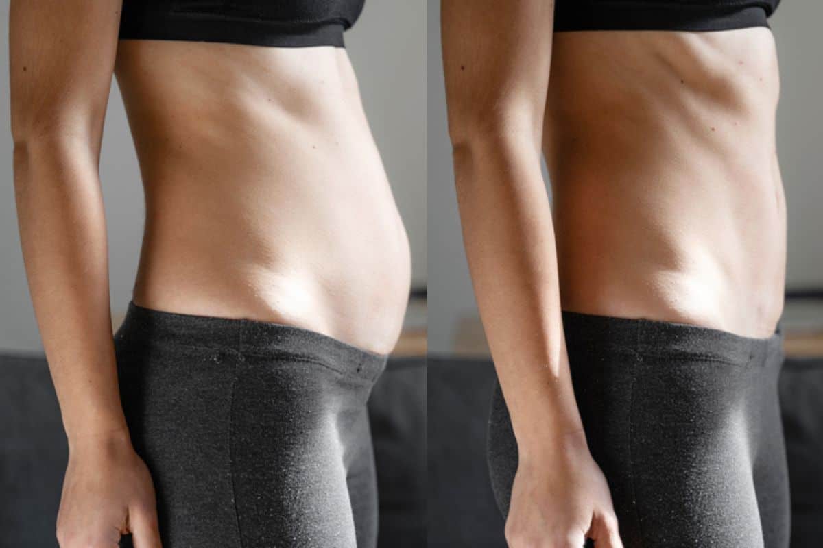 Post-Pregnancy: What Happens to Your Abdominal Muscles After Birth Tolworth
