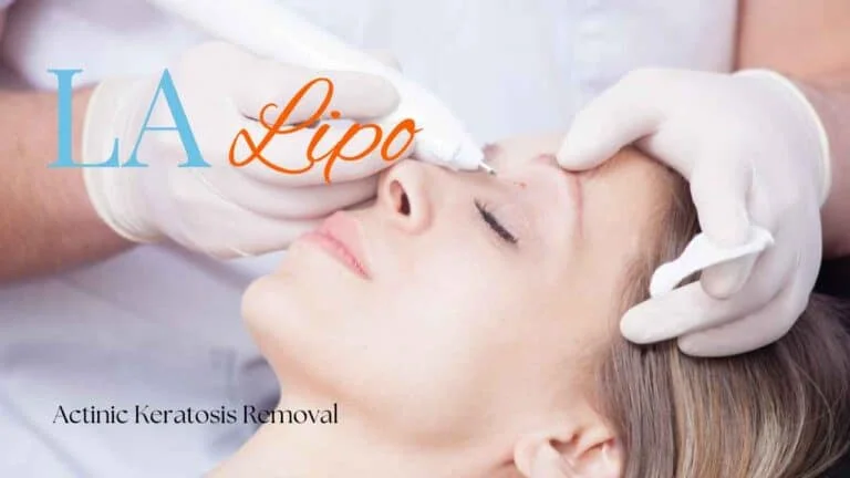 Woman receiving Actinic Keratosis Removal Treatment Tolworth