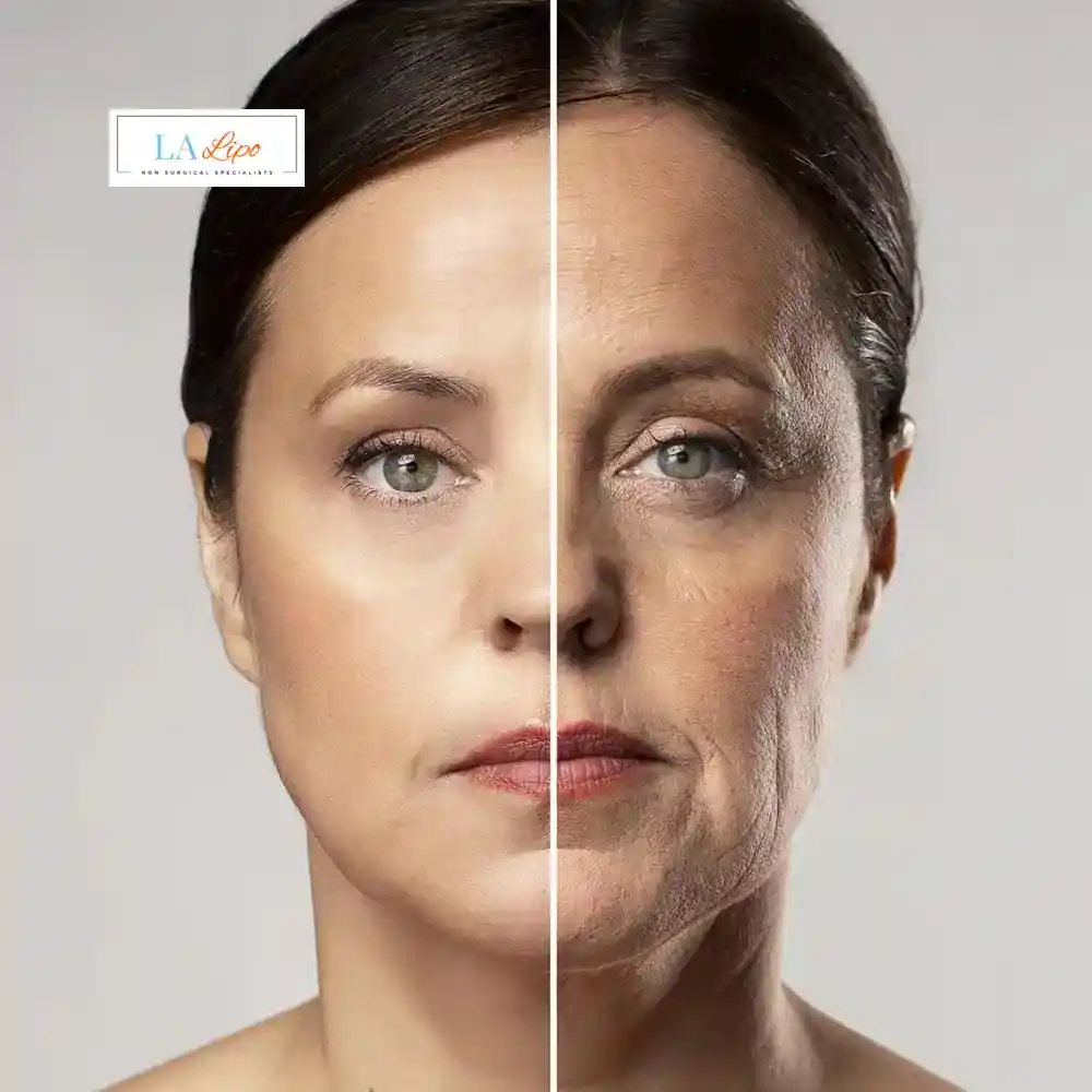 How Can You Tell If Non-Surgical Skin Tightening Is Right for You Tolworth?