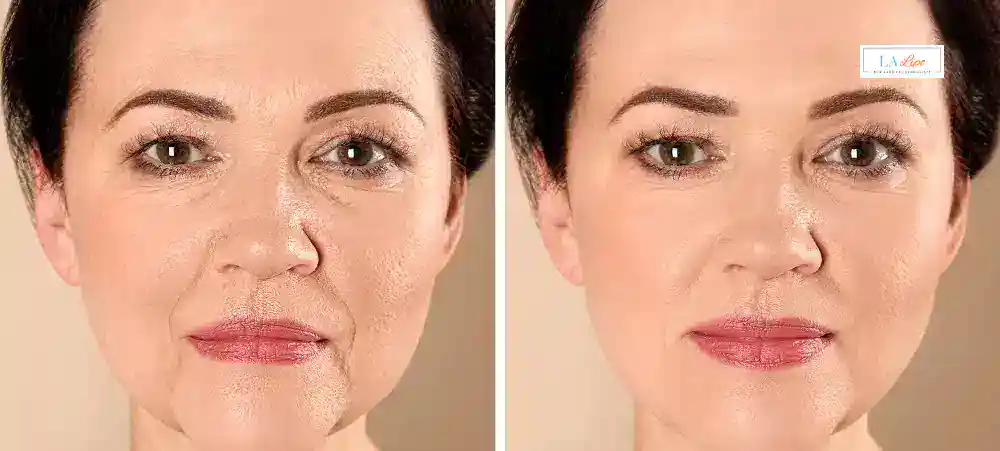 How Long Does It Take to See Results and How Long Do They Last Tolworth?
