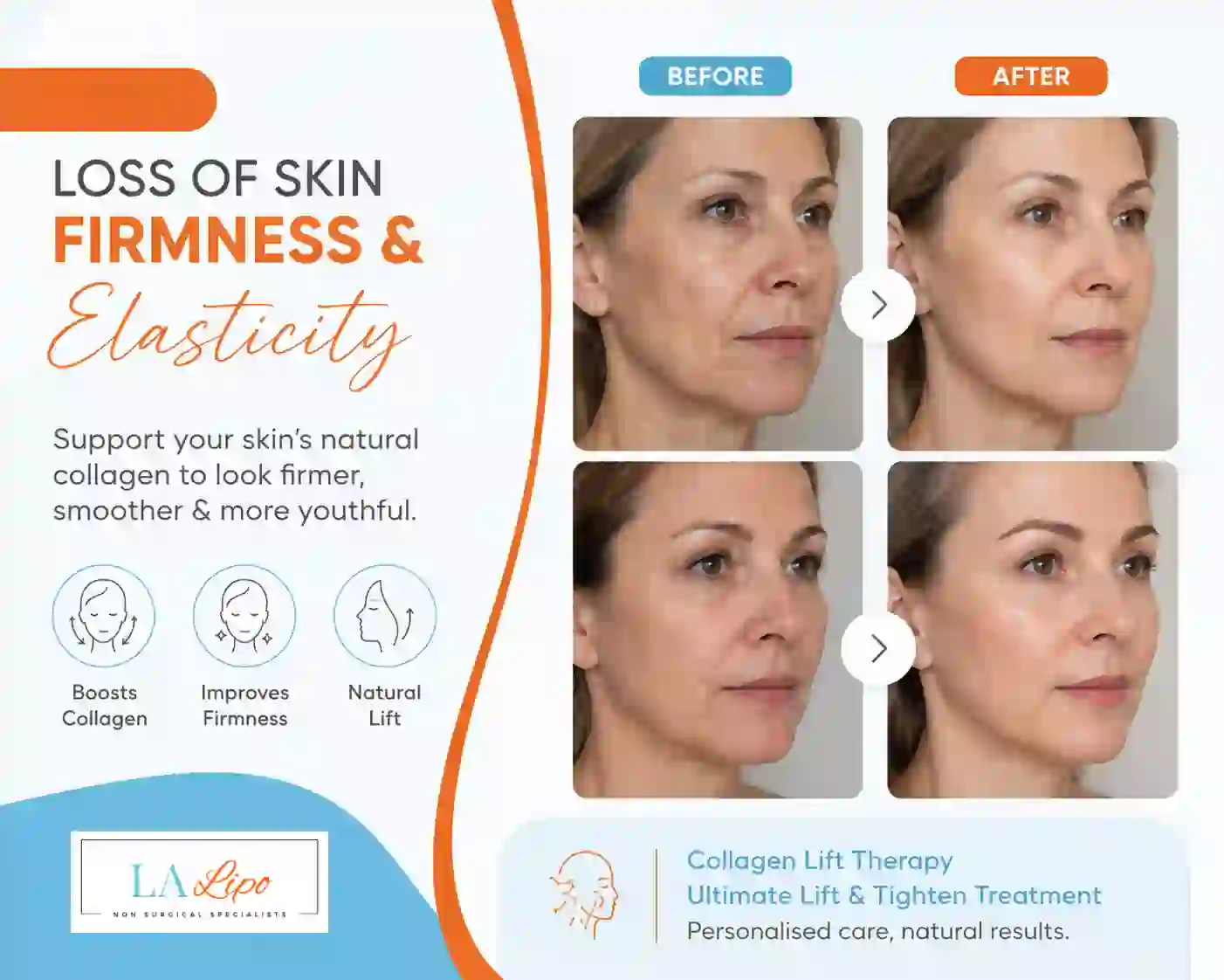 Sign #7: Loss of Skin Firmness and Elasticity Tolworth