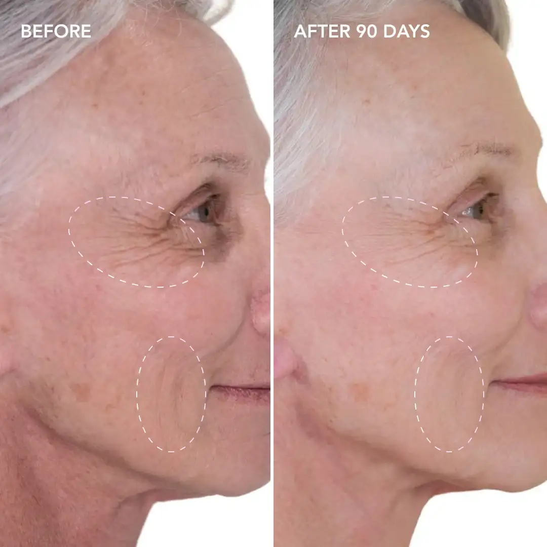 When will you see results Tolworth